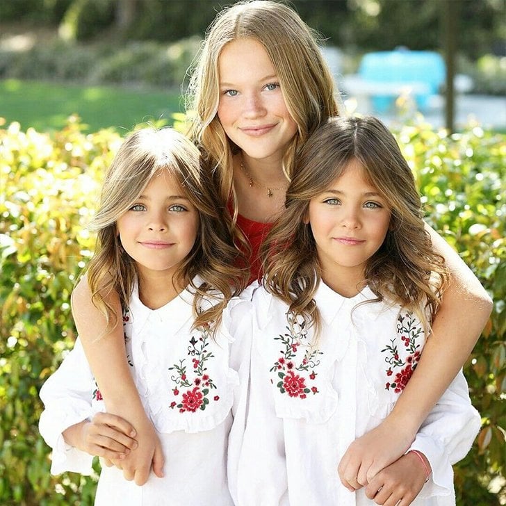 The Incredible Transformation Of The Most Beautiful Twins In The World Page 6 Of 33 Miss